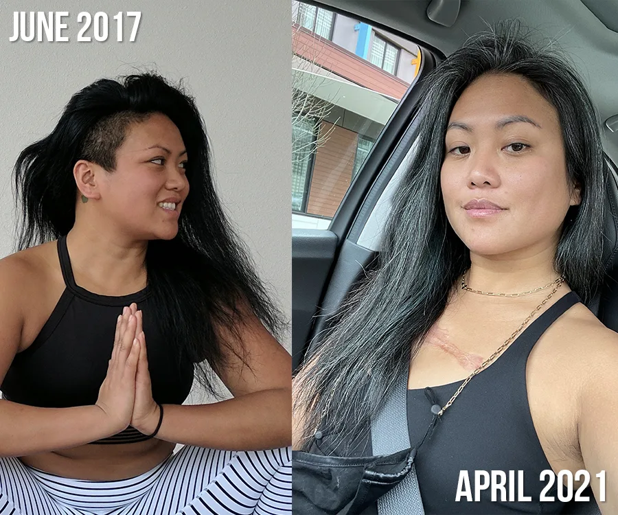 before after gray hair transition asian woman schimiggy